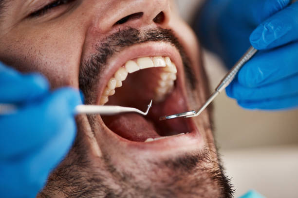 Best Emergency Dentist for Knocked-Out Tooth in Makakilo, HI
