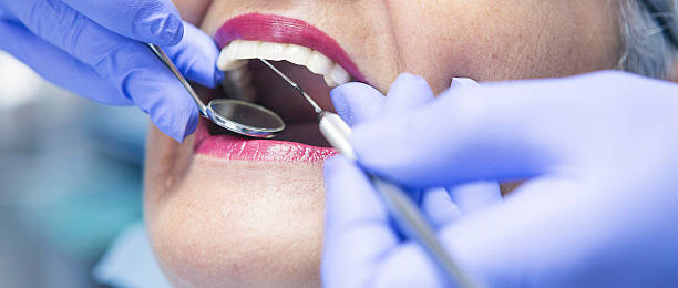 Best Emergency Dentist for Lost Fillings or Crowns in Makakilo, HI